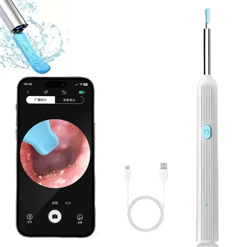Wireless Ear Cleaning Camera – Rechargeable HD Ear Wax Removal Tool with LED Light & Silicone Tips